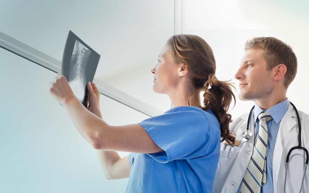 medici che esaminano una radiografia per l'artrosi